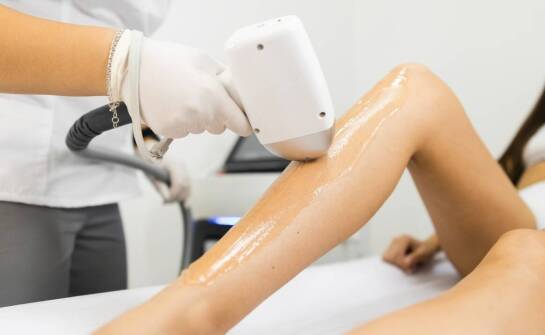 Jak przebiega proces laserowej depilacji krok po kroku?
