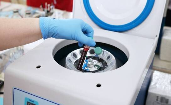 Jak wirówka do osocza wspiera rozwój plastycznej chirurgii?