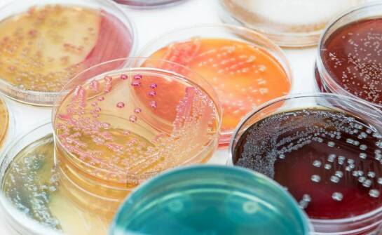 Why are plastic petri dishes preferred in biological laboratories?
