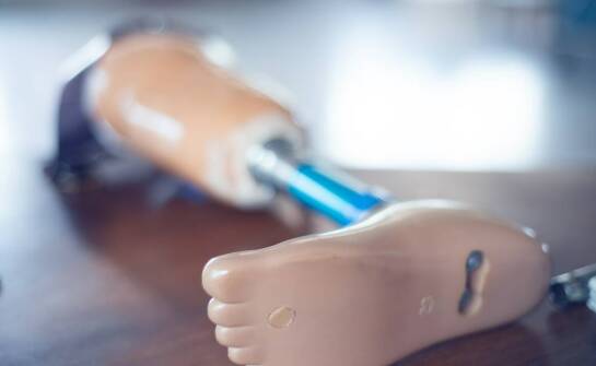 Jakie są różnice kosztowe pomiędzy protezami całej stopy a protezami częściowymi?