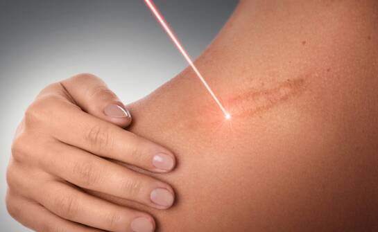 Usuwanie blizn a estetyka skóry – czego oczekiwać po zabiegu?