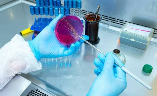 Sterylnie czy aseptycznie? Różnice w zastosowaniu szalek Petriego.
