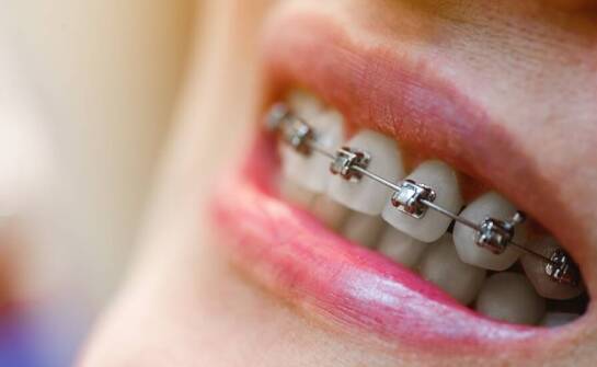 Jakie są najczęstsze błędy w higienie jamy ustnej przy noszeniu aparatu?