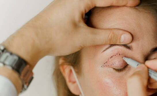 Blefaroplastyka jako część kompleksowej estetycznej terapii twarzy