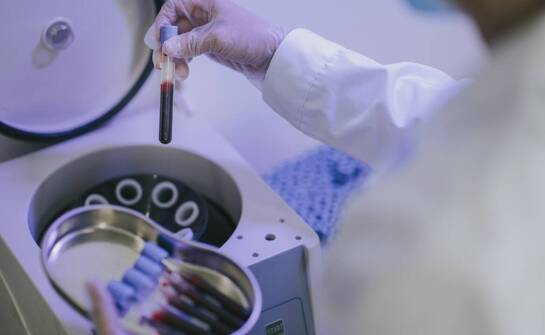 Znaczenie badań krwi w kontekście hormonalnej diagnostyki