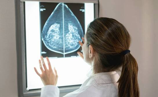 How does the ACR mammography phantom check imaging system performance?