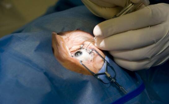 Jakie są najczęściej stosowane metody leczenia przy witrektomii?