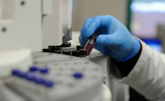 Koloidalne złota związki a ich znaczenie w szybkiej ocenie stanu zdrowia