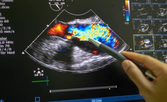 Rola ultrasonografii 3D i 4D w ocenie płodowego serca