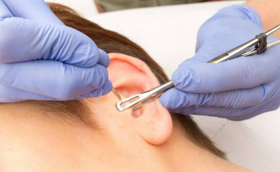 Przekłuwanie uszu w Słupsku – jak znaleźć najlepsze miejsce na zabieg?