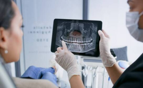 Prześwietlenie zęba: minimalizacja ekspozycji na promieniowanie