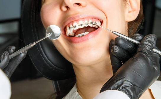 Jak ortodoncja w dentystycznym gabinecie wpływa na zdrowie ustnej jamy?