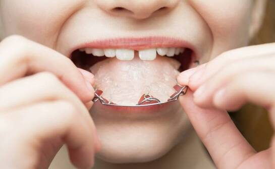 Jakie są najczęstsze problemy związane z noszeniem aparatu i jak im przeciwdziałać?