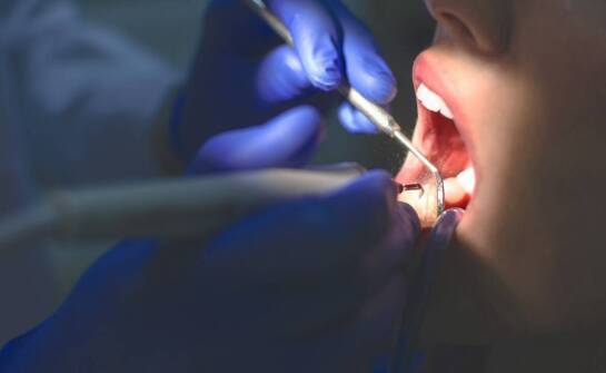 Rola endodoncji w zachowaniu zdrowia zębów – jak działa kanałowe leczenie?
