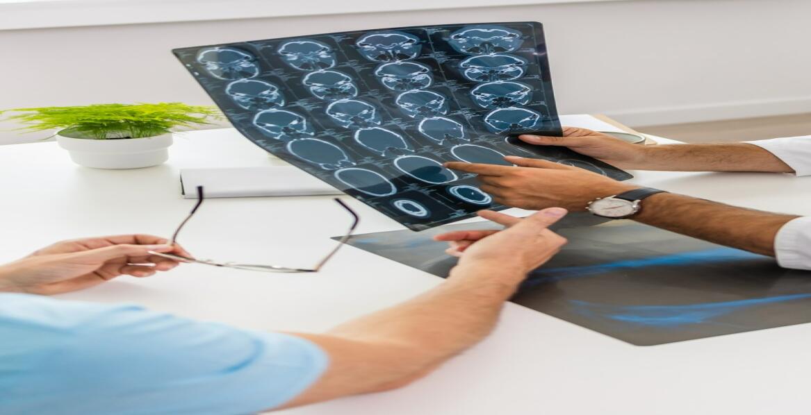 Konsultacje neurologiczne — co warto wiedzieć przed wizytą