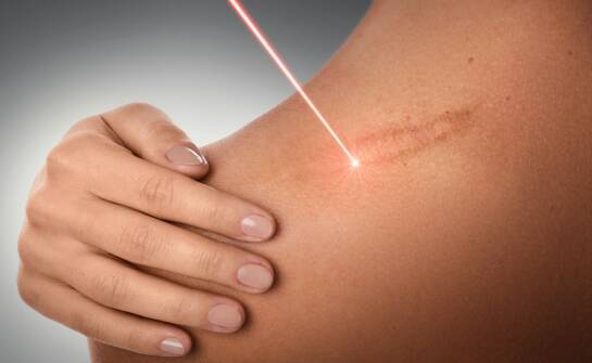 Leczenie laserowe HOLEP: skuteczność, przebieg i najważniejsze informacje