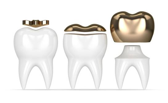 Kompozyty dentystyczne: czym różnią się materiały i zastosowania