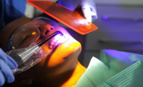 Laserowe zamykanie naczynek — co warto wiedzieć przed zabiegiem