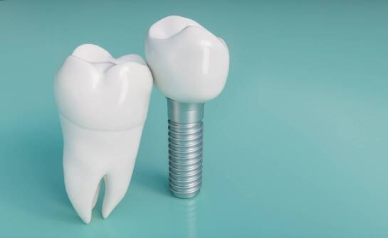 Implant tytanowy czy cyrkonowy — kiedy wybór materiału wpływa na gojenie i estetykę