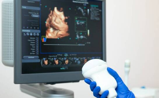 Co naprawdę pokazuje USG 4D w ciąży i czym różni się od obrazu 3D