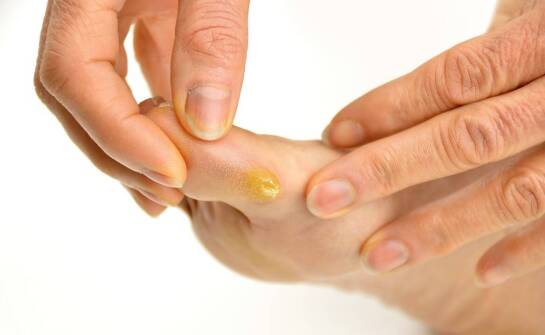 Jak przygotować się do konsultacji dermatologicznej, żeby lekarz lepiej ocenił problem skóry