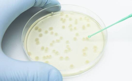 Szalki Petriego w laboratorium mikrobiologicznym: jakie parametry wpływają na pracę z próbkami