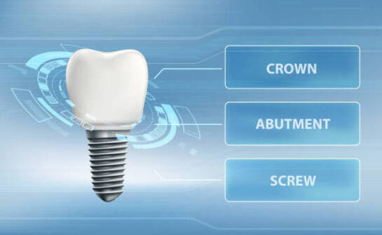 Od czego zależy koszt etykiet UDI na opakowaniach implantów dentystycznych