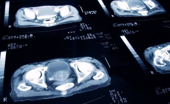 Kiedy nietrzymanie moczu wymaga diagnostyki uroginekologicznej zamiast zwykłej kontroli