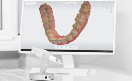 Diagnostyka 3D przed leczeniem nakładkami — co ocenia ortodonta przed planem terapii