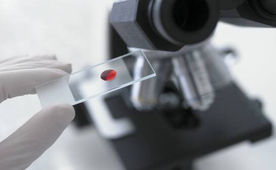 Jak rodzaj szkiełka wpływa na wiarygodność obserwacji w laboratorium chemicznym