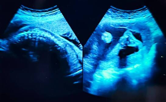 USG w diagnostyce dolegliwości — kiedy badanie wyjaśnia ból, a kiedy wymaga uzupełnienia