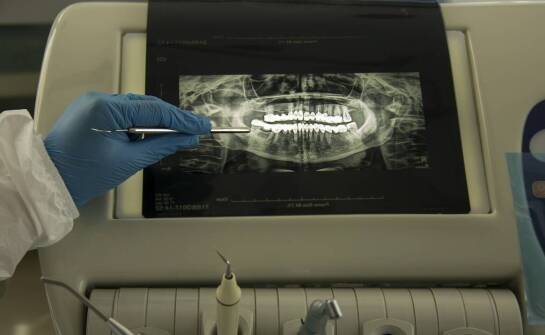 Jak zmienia się diagnostyka i plan leczenia, gdy wspierają je mikroskop, laser i cyfrowe RTG