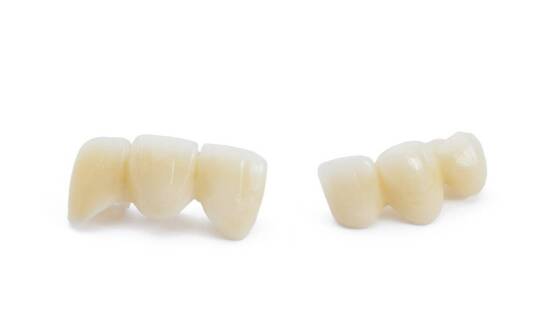 Dwuwarstwowe modelowanie kompozytu estetycznego w odbudowach przednich i bocznych — kiedy wystarcza Body i Enamel
