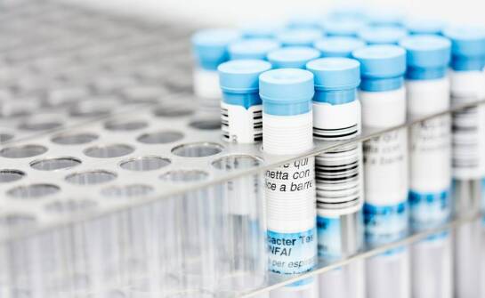 Jak ocenić, czy wytwórca kolagenu liofilizowanego rzeczywiście kontroluje jakość produktu