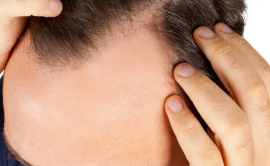 Trycholog w Polsce — kompetencje, kwalifikacje i granice współpracy z dermatologiem