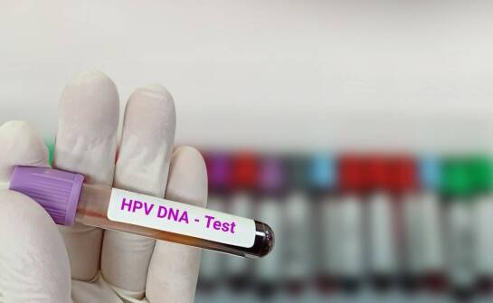 Dlaczego regularna cytologia ma znaczenie w profilaktyce raka szyjki macicy u kobiet z mniejszych miejscowości