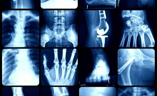 Kiedy po urazie potrzebna jest konsultacja ortopedyczna i jakie badania pomagają postawić diagnozę