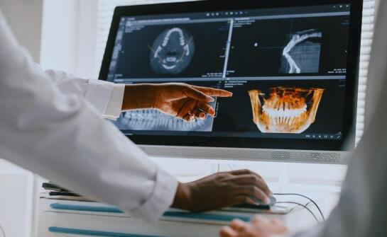 Dlaczego tomografia 3D ujawnia problemy, których nie widać przed leczeniem kanałowym