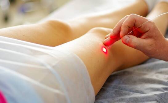 Kiedy żylaki kwalifikują do laserowego leczenia i jak wygląda ście żka pacjenta na Śląsku