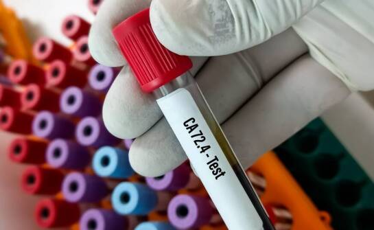Jak dobrać etykietę do próbki w laboratorium, gdy liczą się chłód i chemia