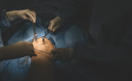 Od czego naprawdę zależy wycena osteotomii kolana u aktywnego pacjenta