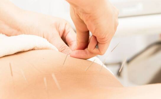 Jak terapia manualna i akupunktura bywają łączone przy napięciowych bólach głowy