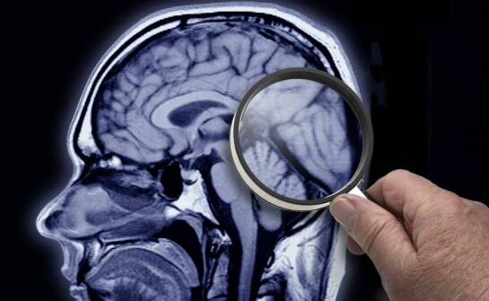 Oponiak przy podstawie czaszki — kiedy objawy oczne i neurologiczne wymagają pogłębionej diagnostyki