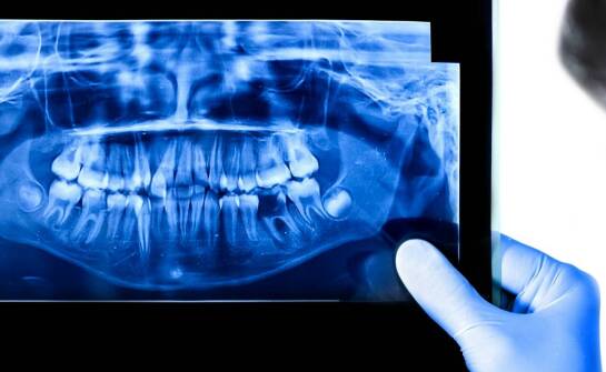 Kiedy RTG zębów u psa lub kota ujawnia problemy niewidoczne gołym okiem