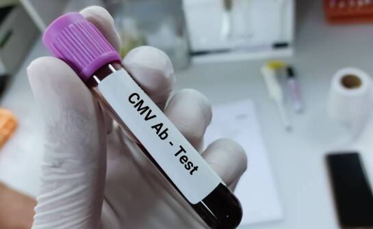 Co decyduje o wiarygodności oznaczania pp65 CMV w laboratorium diagnostycznym