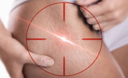 Jak dobrać laseroterapię do przebarwień, blizn i oznak starzenia skóry po 30. roku życia