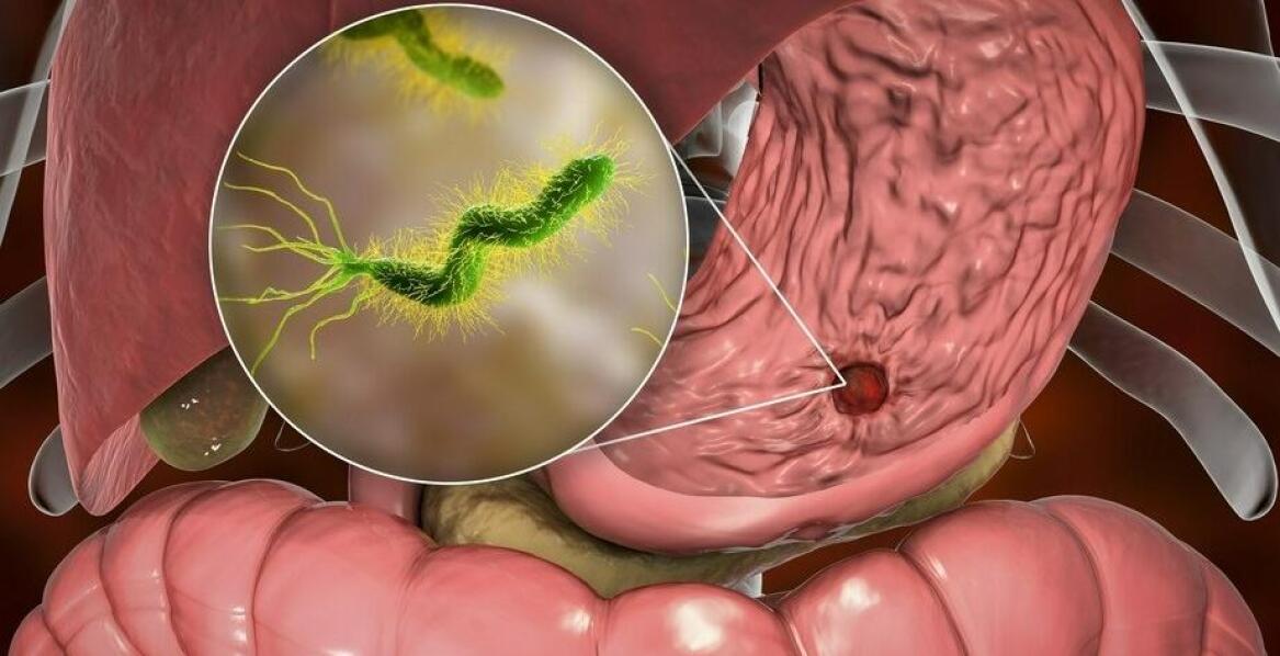 Czym jest peptyd BPC 157? Właściwości i zastosowanie