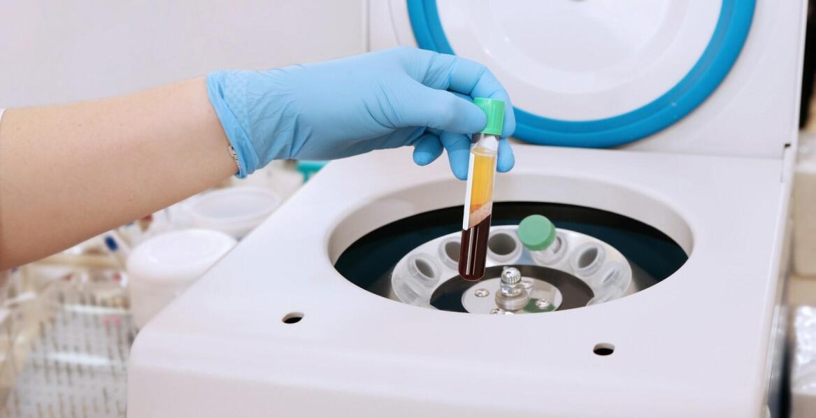 Osocze bogatopłytkowe - szereg korzyści