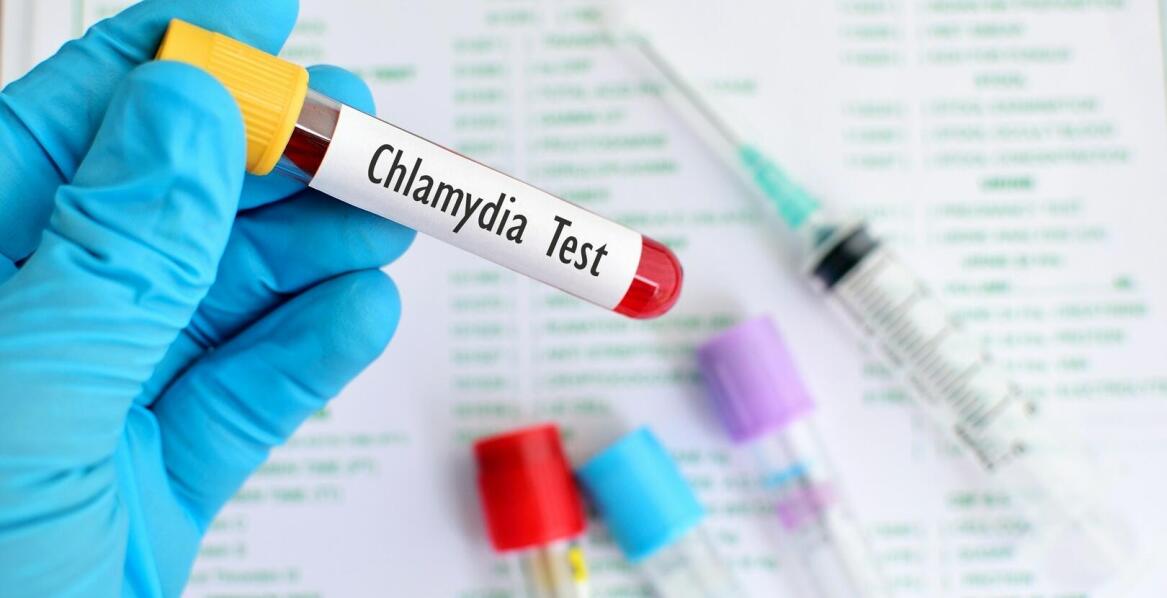 Jakie objawy daje chlamydia i jak ją zdiagnozować?