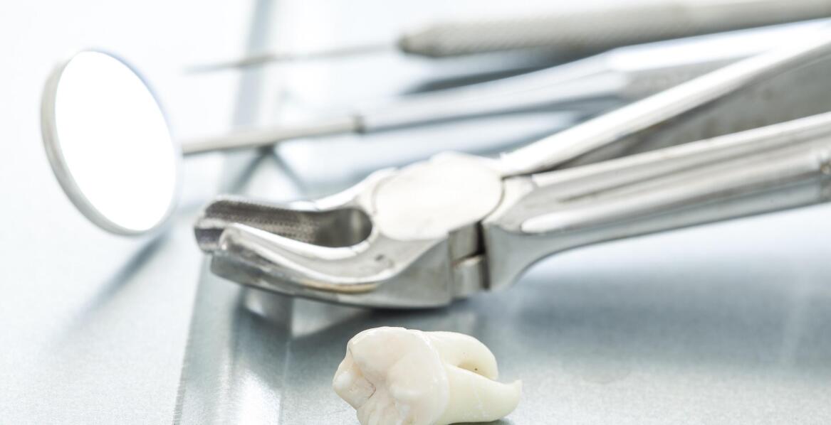 Jak przygotować się do chirurgicznego usunięcia ósemek?